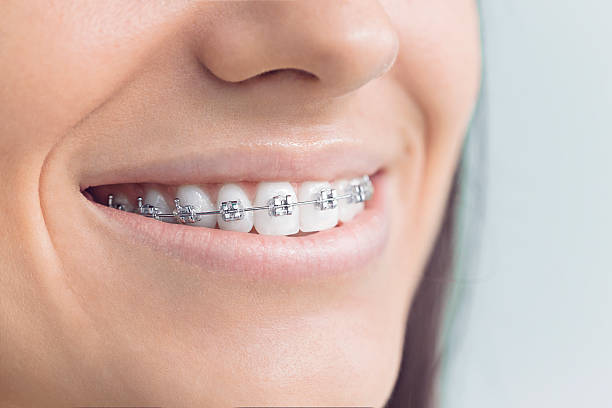 Best Invisalign and Clear Aligners  in Gulfport, FL
